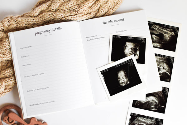 Blank Ultrasound Photo Album: Newborn Scrap Book Baby's First Year Memory  Book