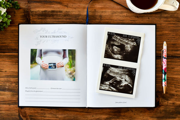 Dear Baby: A Pregnancy Prayer Journal & Memory Book for Expecting Moms by Duncan & Stone | Pregnancy Keepsake | Scrapbook Album for Milestones | Baby Announcement | New Mom to Be Gift