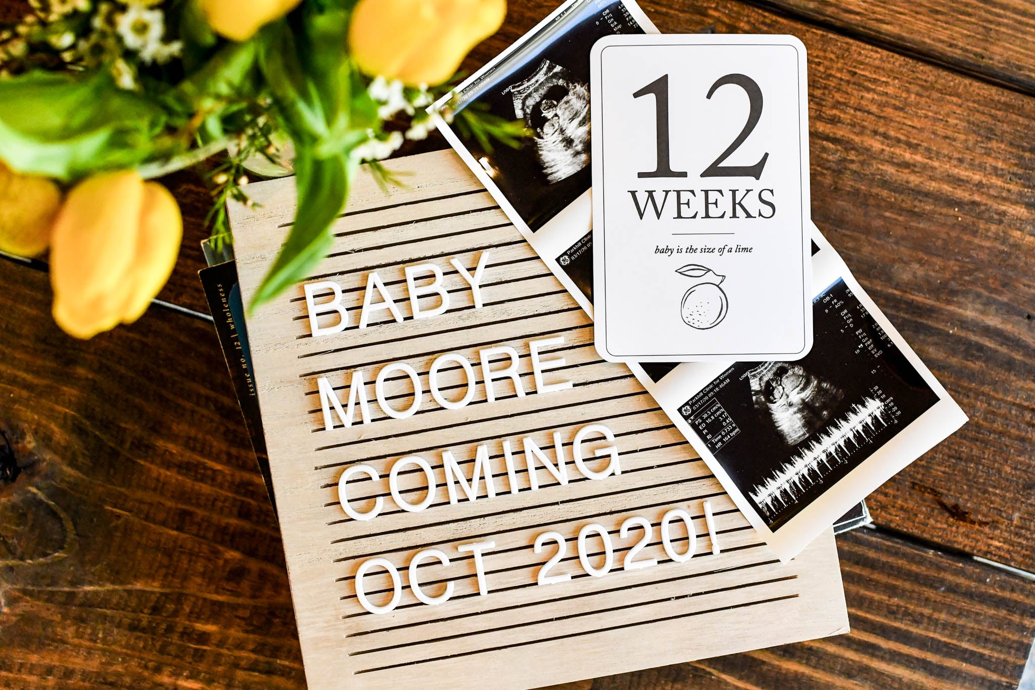 Pregnancy Milestone Cards by Duncan & Stone | Baby Announcement | Expecting Mom Gift Box | Family Shower Present | Gift for Mother to Be | Photo Props